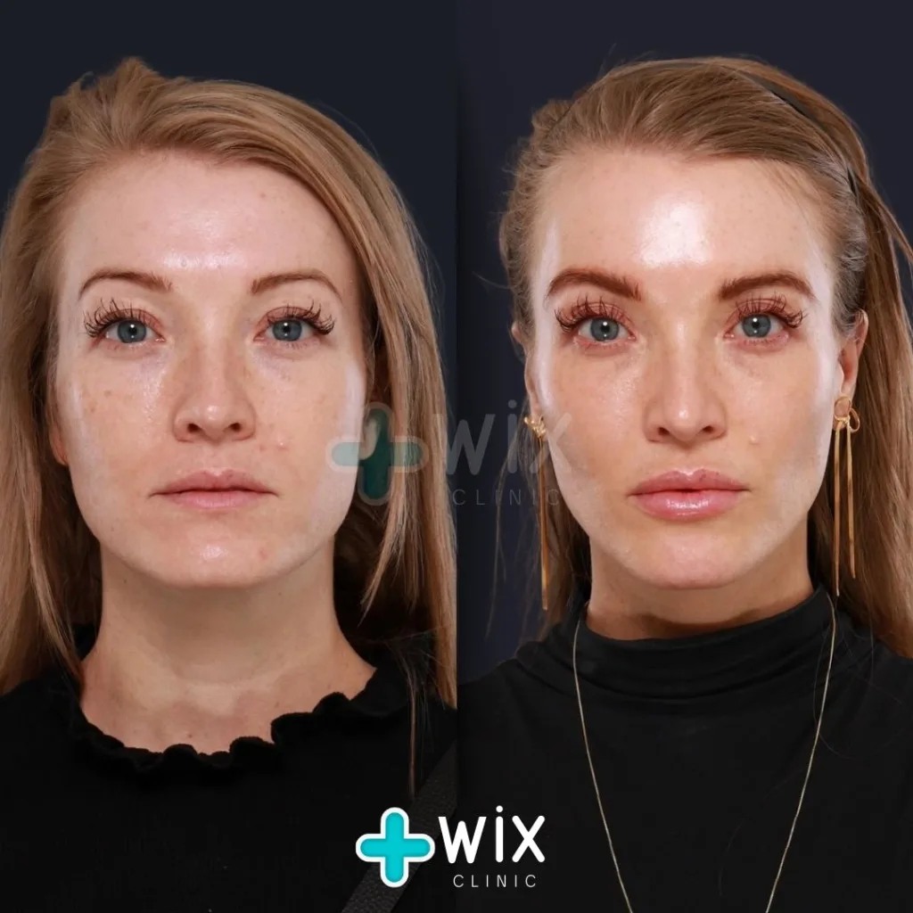 Face Medical Before and After