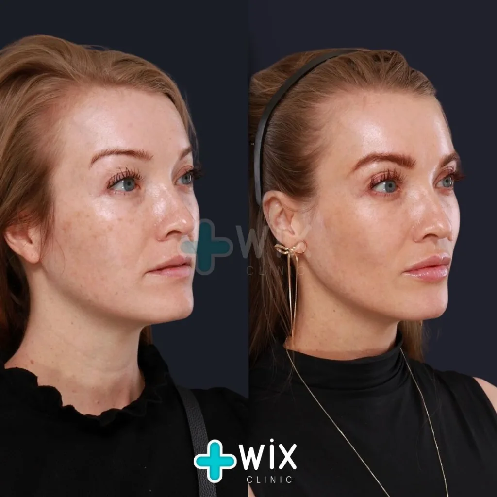 Face Medical Before and After