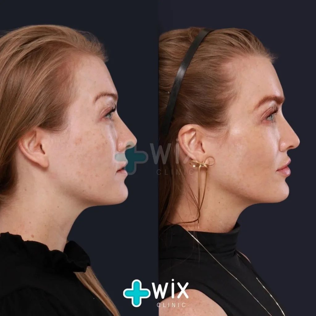 Face Medical Before and After