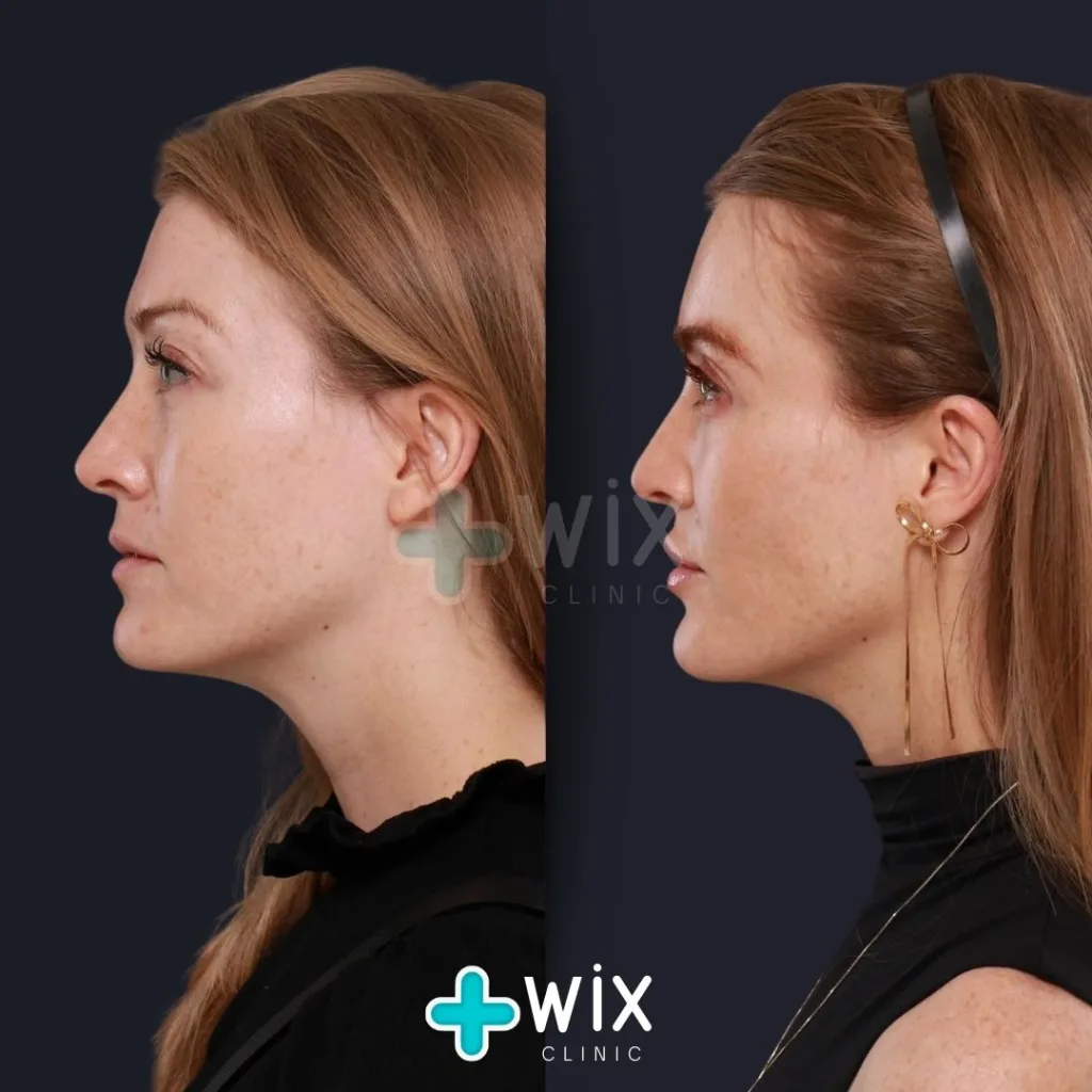 Face Medical Before and After