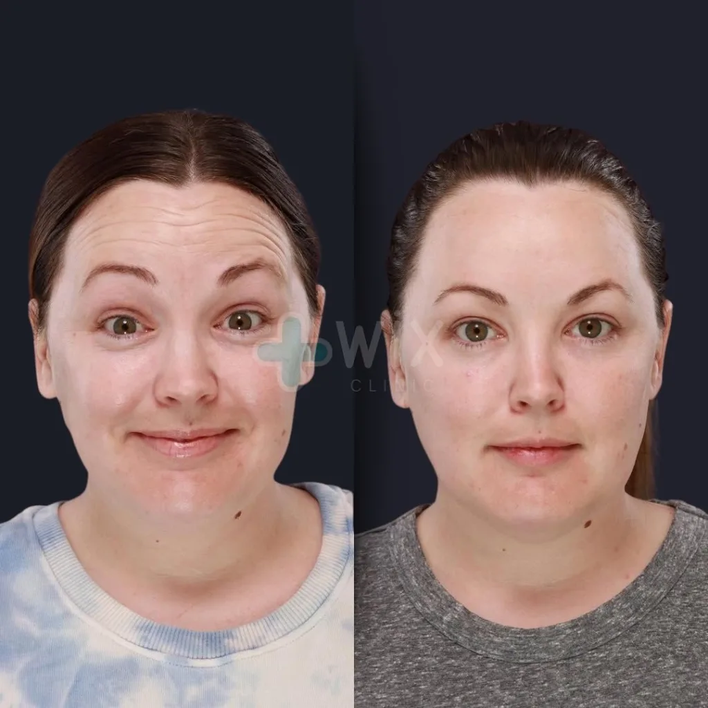 Face Medical Before and After