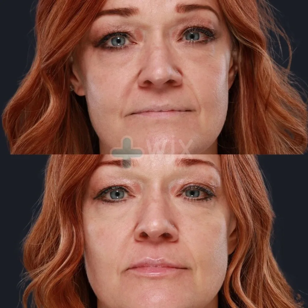 Face Medical Before and After