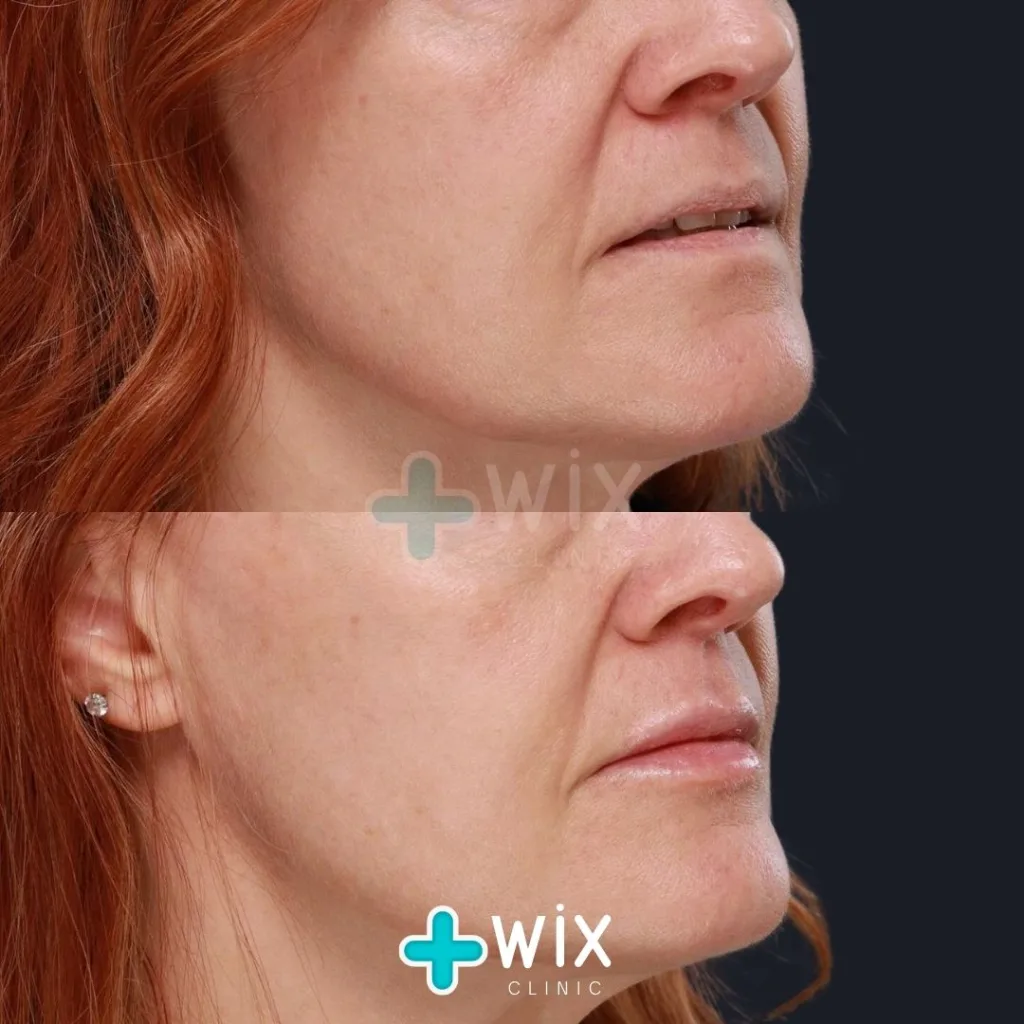 Face Medical Before and After