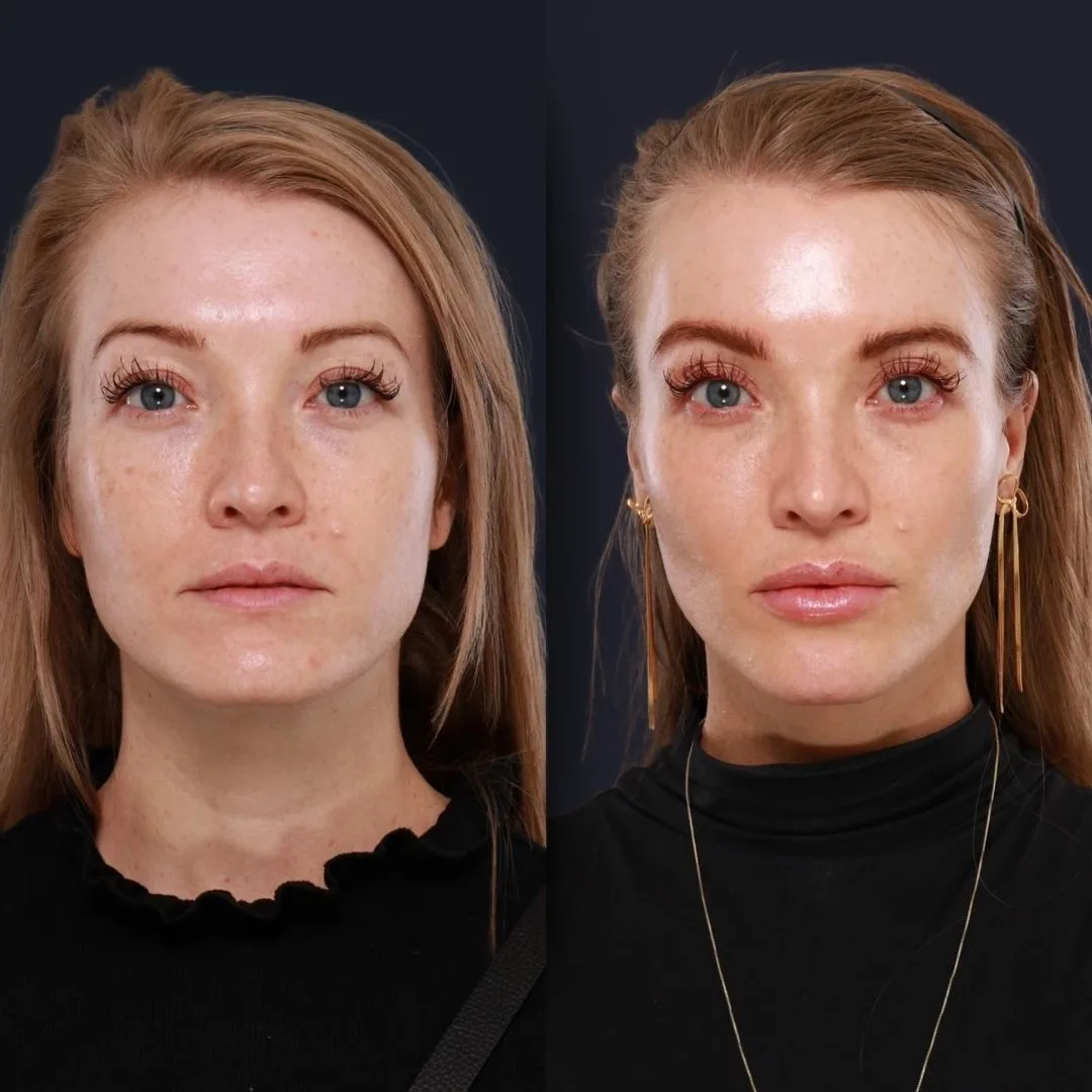 Face Medical Before and After