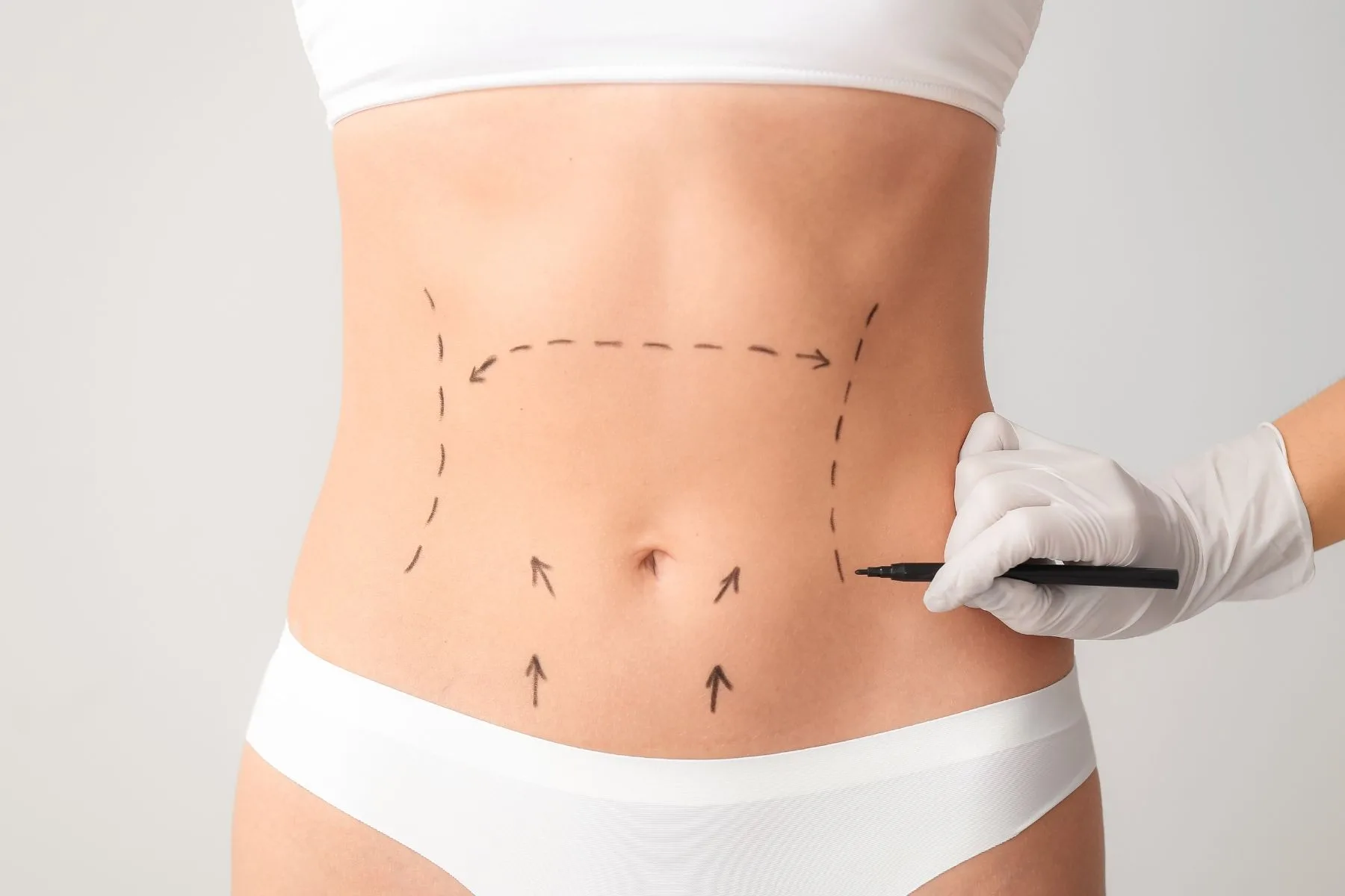 Plastic Surgery in Turkey
