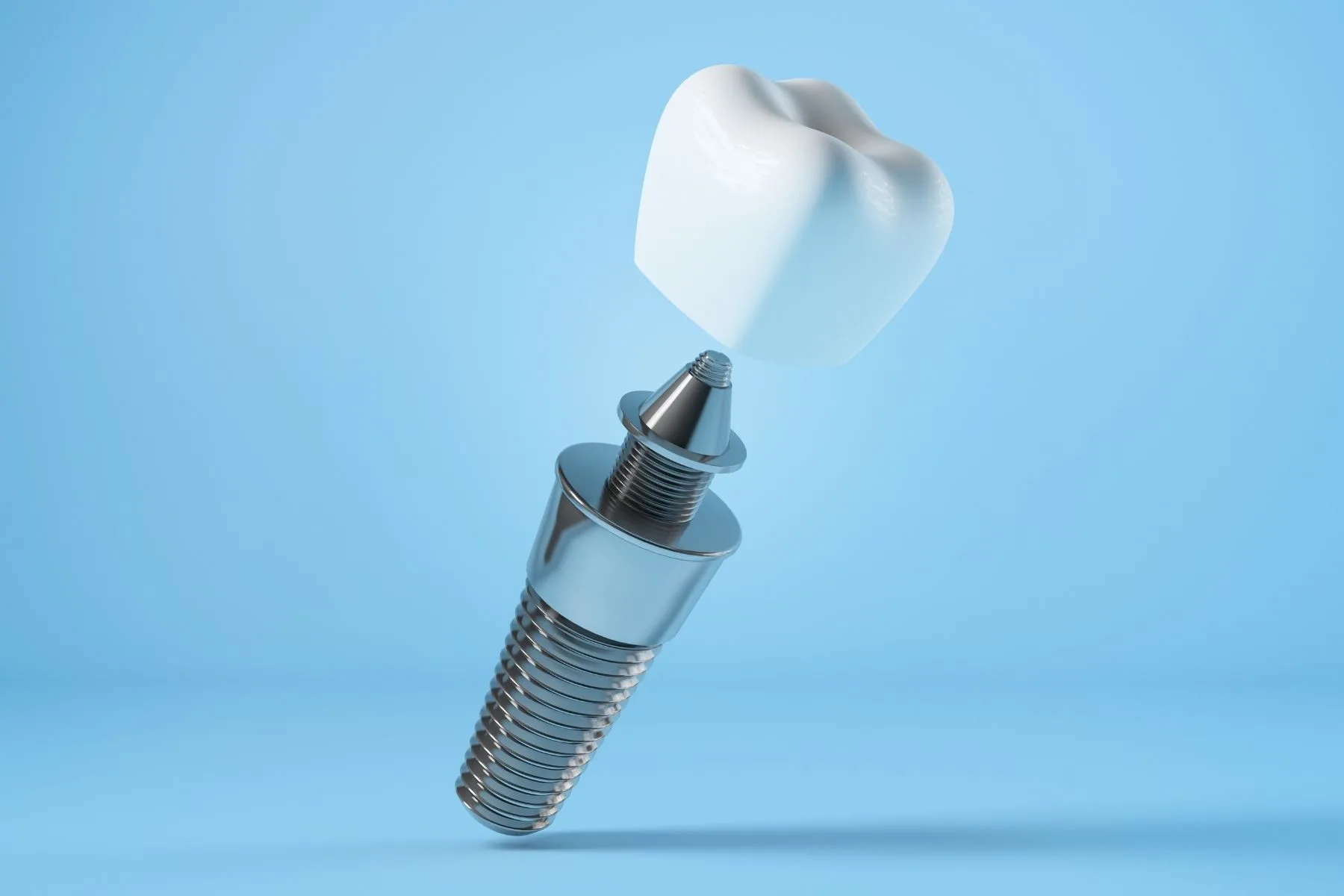 Same-Day Dental Implants in Turkey 1 Same-Day Dental Implants in Turkey