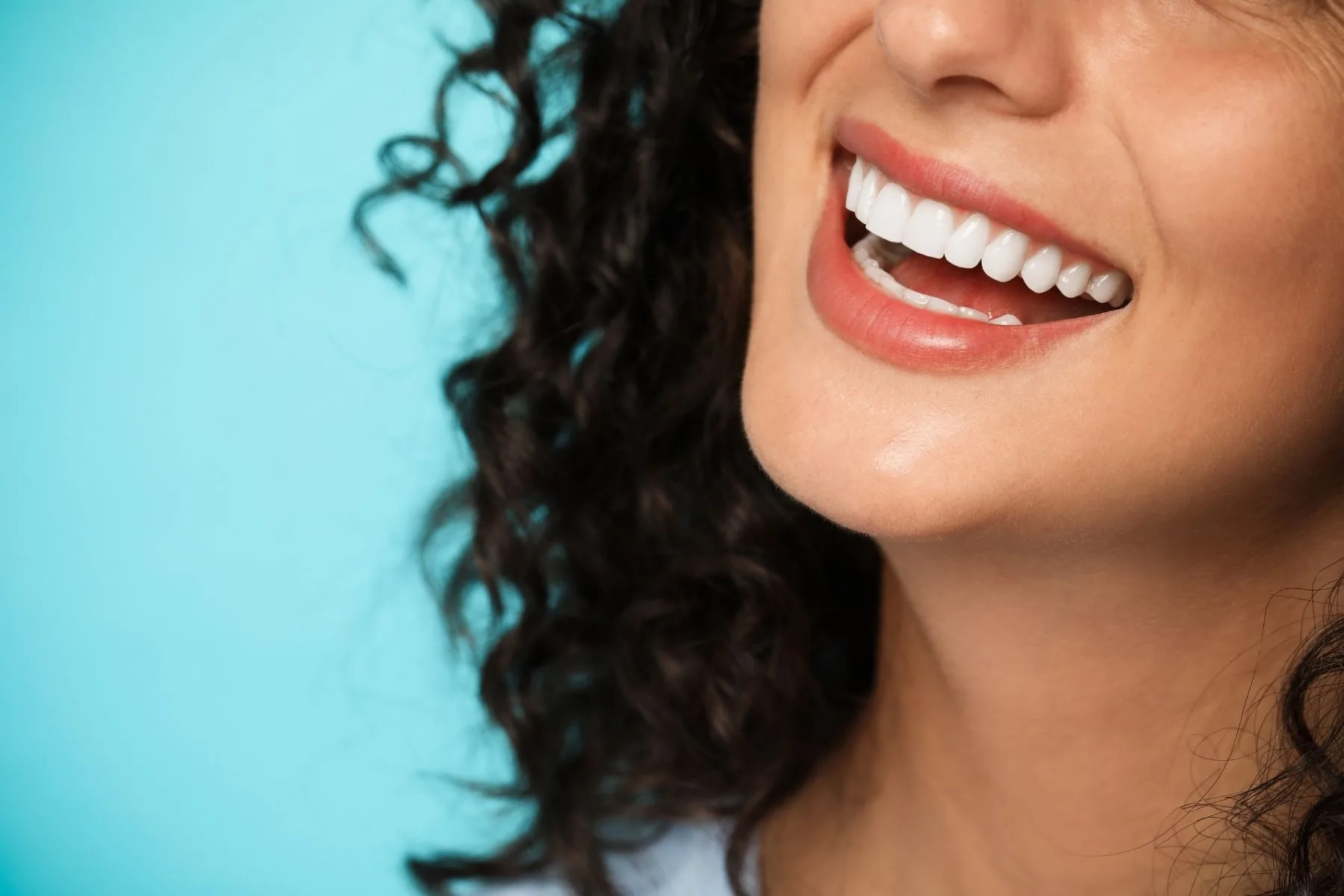 Smile Makeover in Turkey