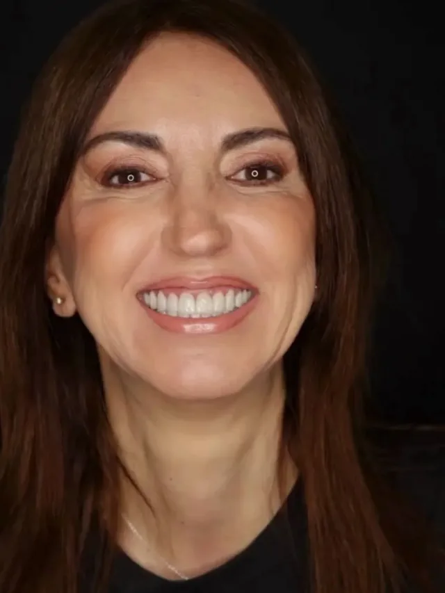 Gretchen – Smile Transformation in Turkey