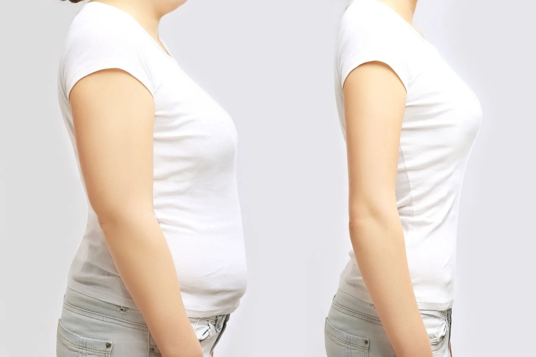 Weight Loss Surgery in Turkey